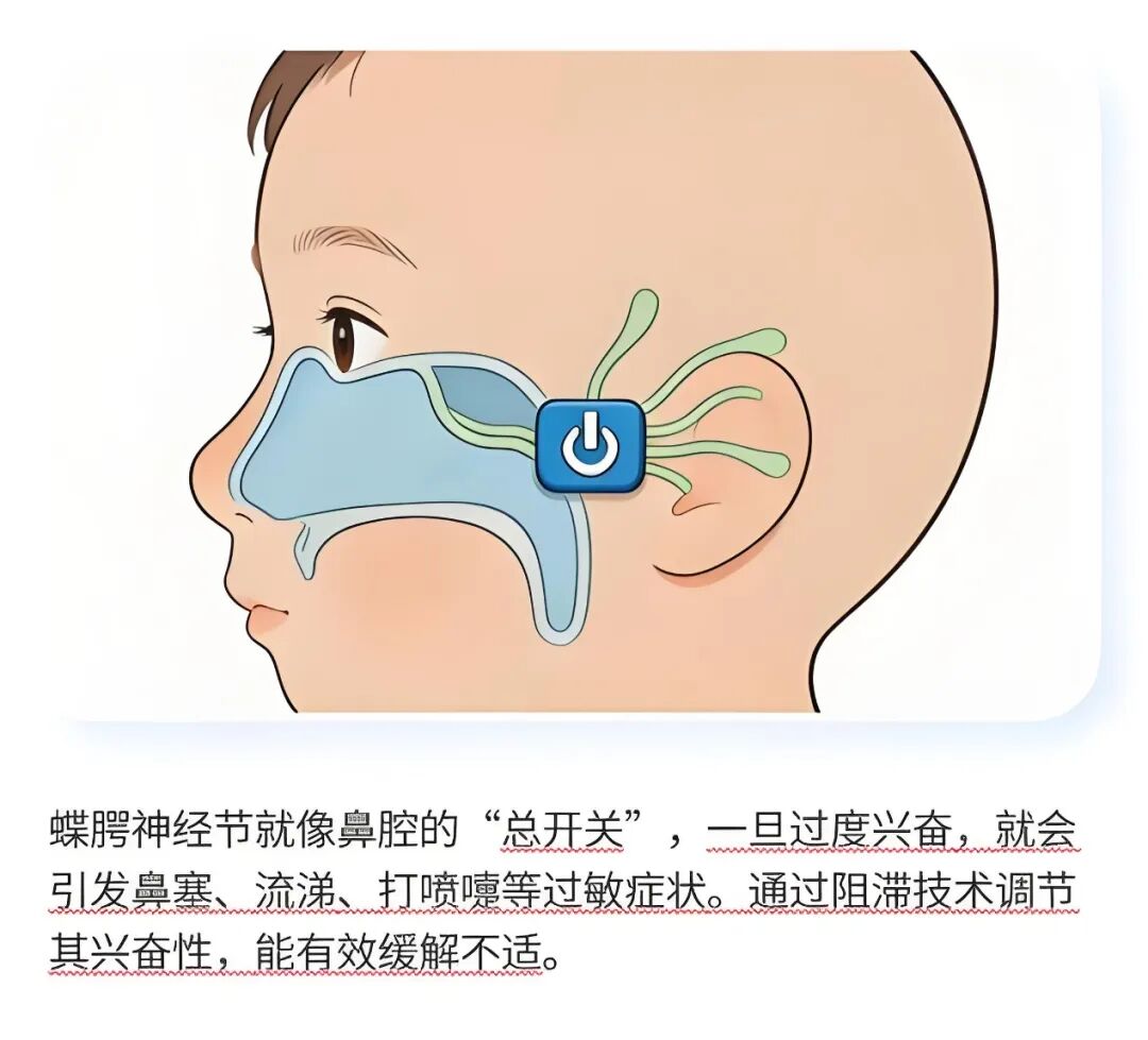 儿童鼻炎,太上头!每晚听孩子"呼噜"像拉风箱,这个方法终于让我们睡了个整觉