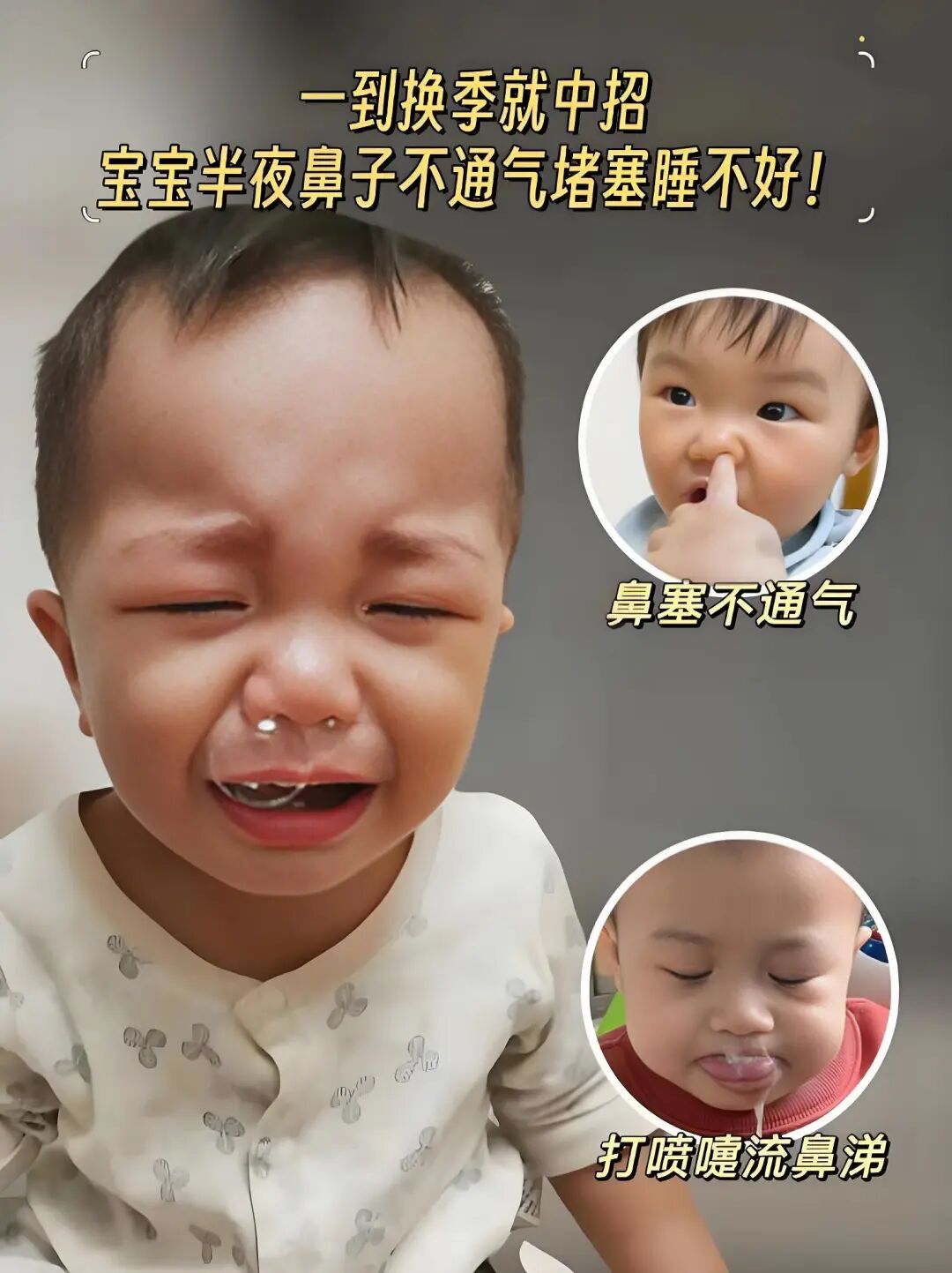 儿童鼻炎,太上头!每晚听孩子"呼噜"像拉风箱,这个方法终于让我们睡了个整觉