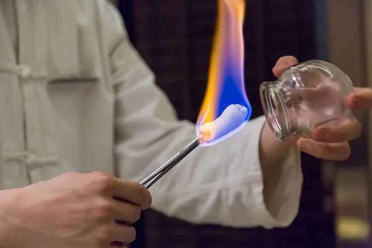 拔火罐吸出来的瘀血,是体内的毒素?告诉你真相