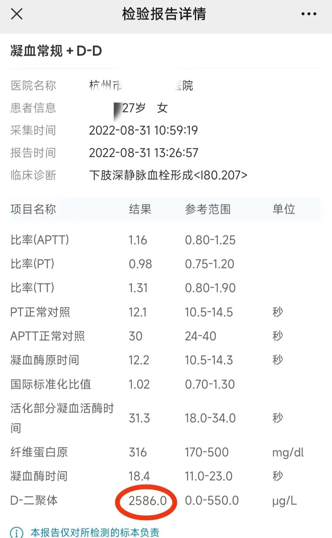 “看看,大腿、小腿、胯部、腹部全都是栓子,静脉快堵死了”