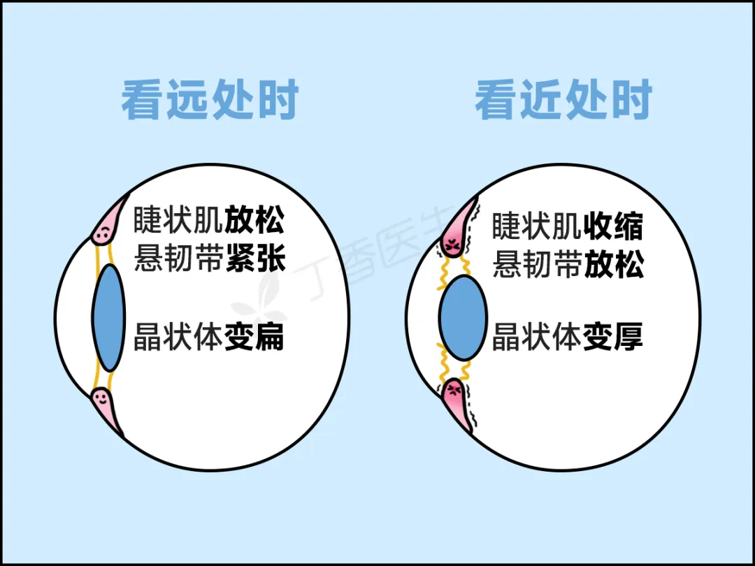 避免不了过度用眼，但必须学会恢复方法
