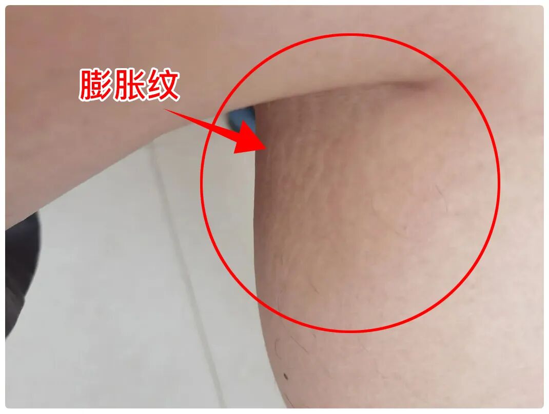 吃饭时1个小习惯,竟然能防4种病?一日三餐这样做,身体会感谢你