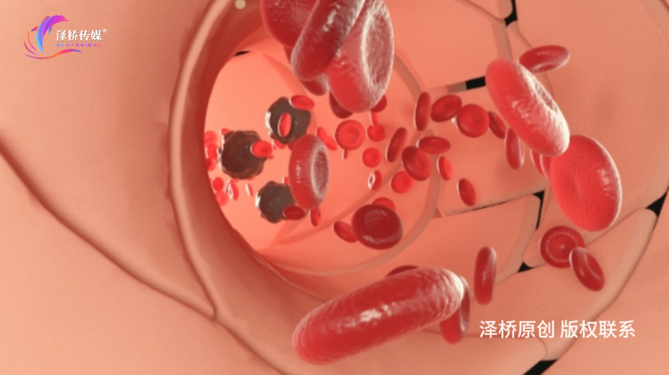 脚踝一到晚上就肿，是肾不好吗？真正原因可能有这4个