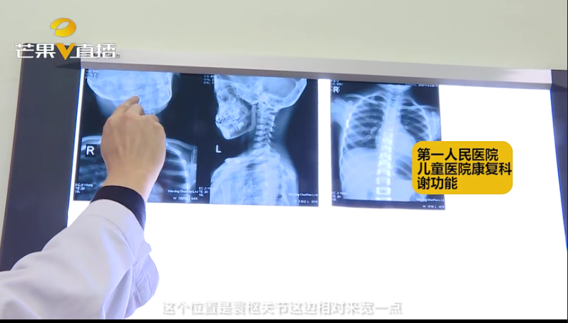 为什么假期天天躺着反而不舒服？3招教你缓解