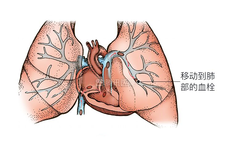 这个姿势，竟是健康杀手，教你几招找回健康