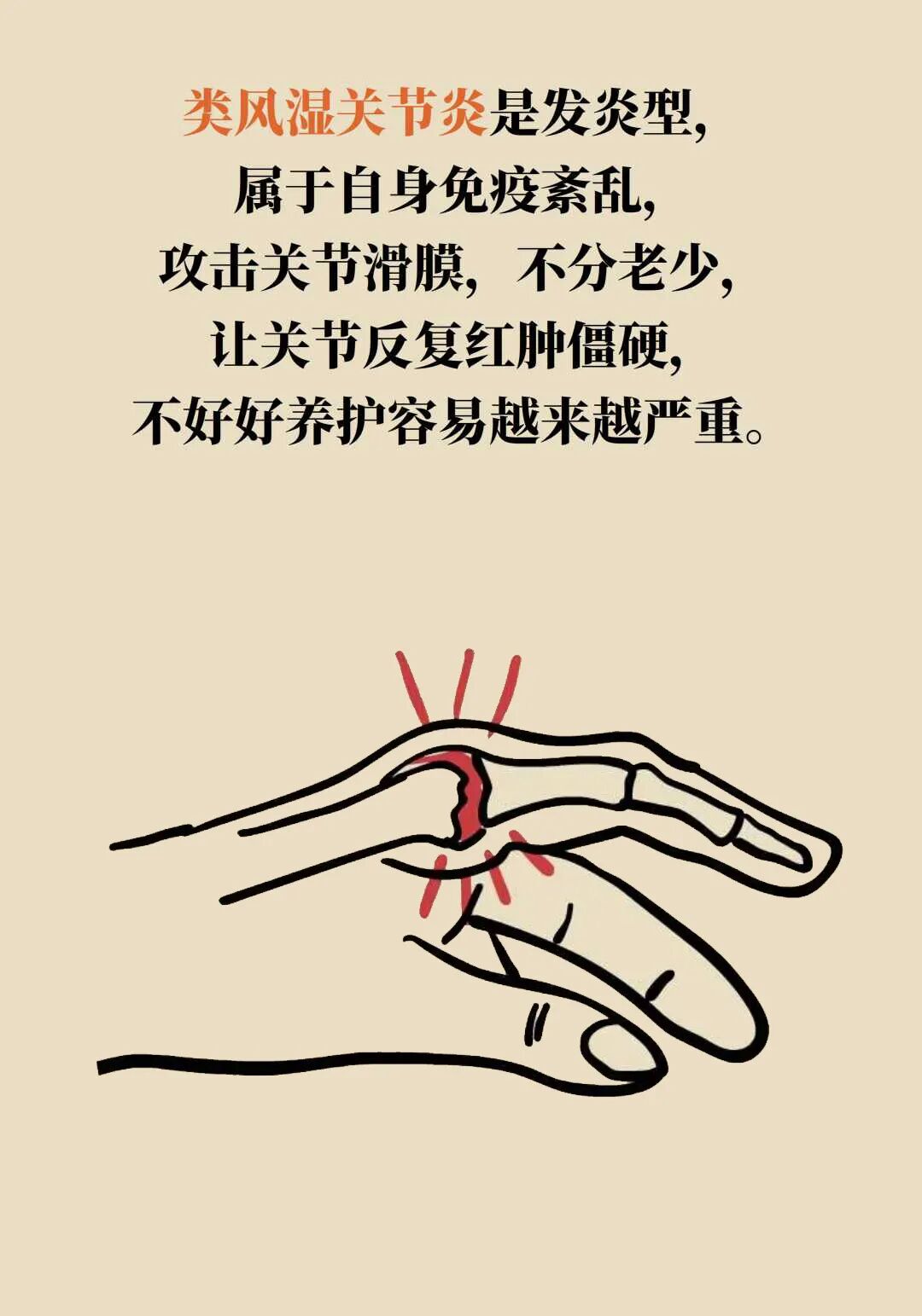 得了关节炎,到底还能不能运动?