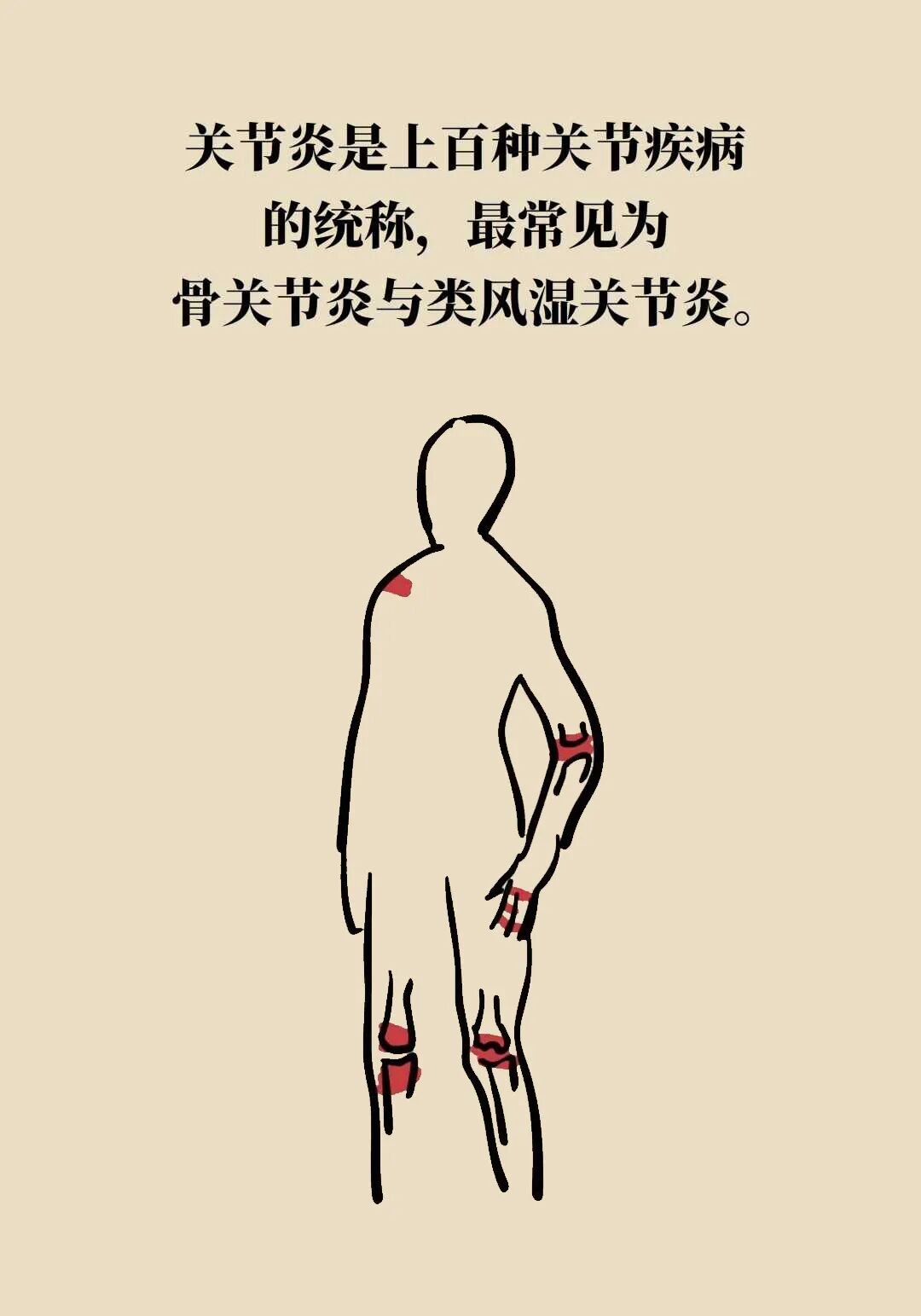 得了关节炎,到底还能不能运动?