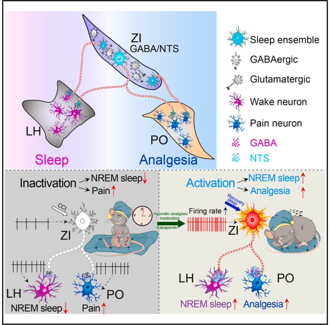 Neuron丨睡个好觉为什么能镇痛?安述明/曹君利/孙海艳团队揭示恢复睡眠经ZI睡眠神经元群介导镇痛