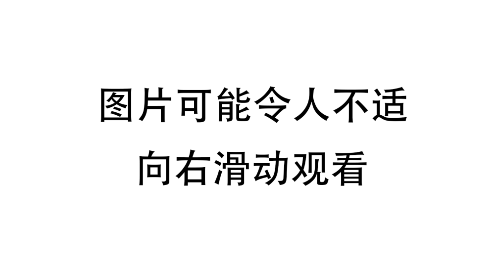 成功取出鼻腔内“水蛭”，系墨脱县人民医院首次开展！