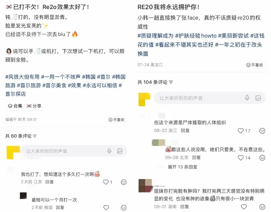 香港查获一批网红医美“尸皮针”，38岁女子涉非法人体器官交易被捕；此前3000元一针“尸皮针”爆火，系死人皮肤组织打进活人脸里