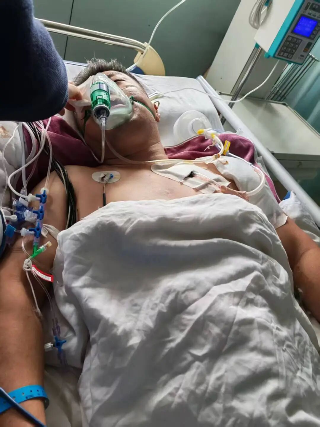 山东聊城男子疑因幻听行凶致2死1伤案，一审宣判：被告人刘某奇死刑；其患精神分裂症，被评定为限定刑事责任能力，但不足以从轻处罚